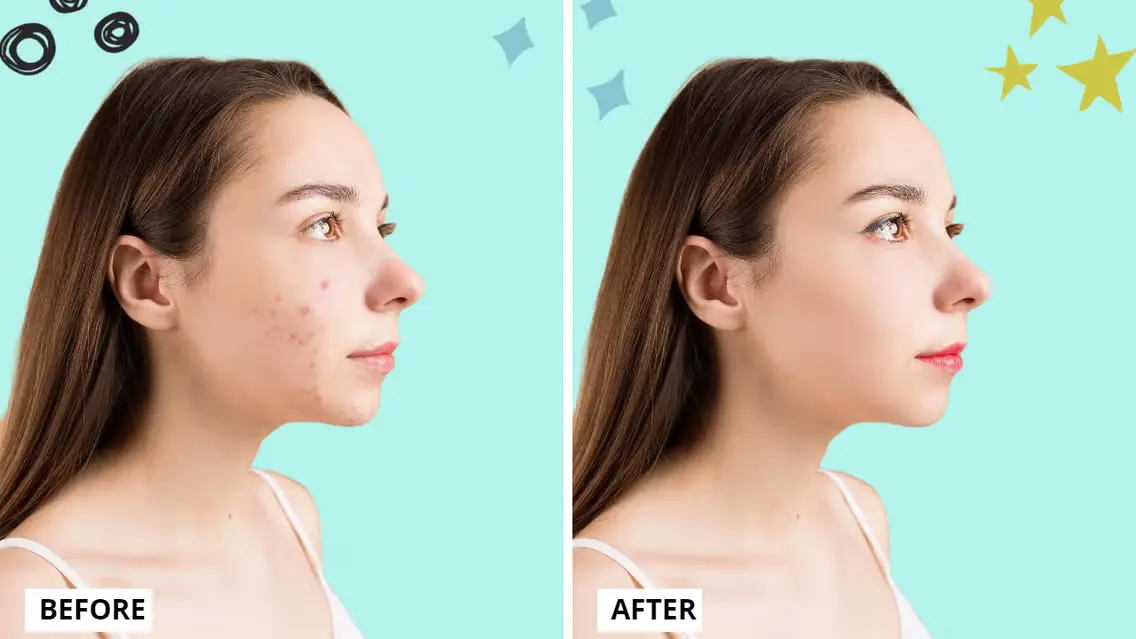 how to make before and after pictures